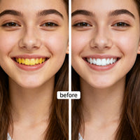 WHITE Teeth Sticker Teeth Whitening Sticker